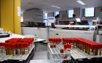 Els usuaris puntuen amb un notable alt l’atenció rebuda al Servei d’Anàlisis Clíniques de son espases