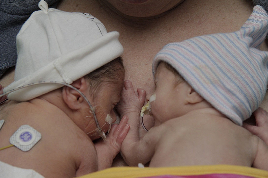 Esta imagen ilustra que: Cada año nacen más de doscientos niños prematuros en Son Espases