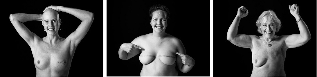 Esta imagen ilustra que: Son Espases acull l’exposició fotogràfica “Costuras a flor de piel”