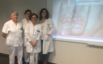 El Servei de Dermatologia organitza un taller per a pediatres i infermers d’atenció primària sobre el tractament de berrugues i mol·luscos contagiosos