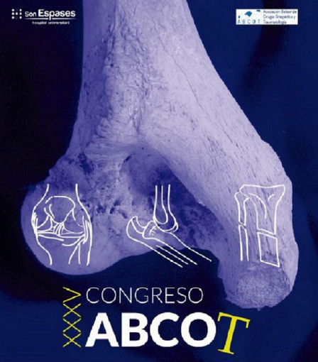 Esta imagen ilustra que: XXXV Congreso de Traumatología