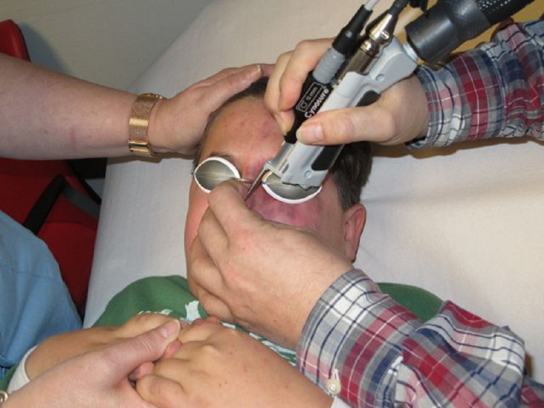 Esta imagen ilustra que: El Servei de Dermatologia adquireix el làser de colorant per eliminar les taques vermelles de la cara que servirà per evitar el desplaçament dels pacients a la península