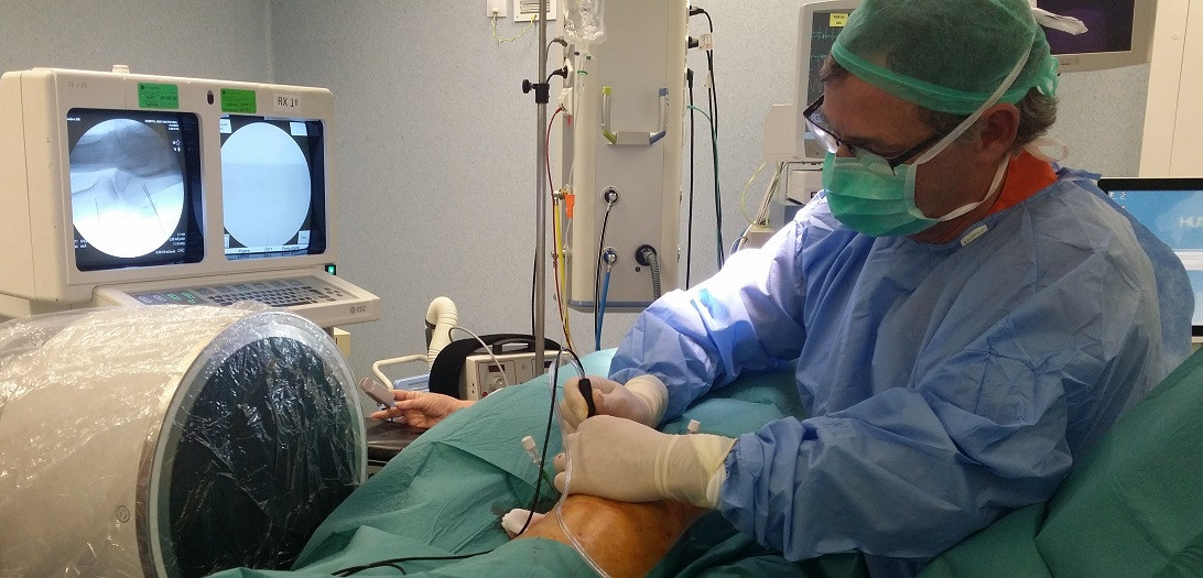 Esta imagen ilustra que: Traumatologia de Son Espases aplica una tècnica quirúrgica de radiofreqüència per eliminar el dolor dels genolls amb osteoartritis