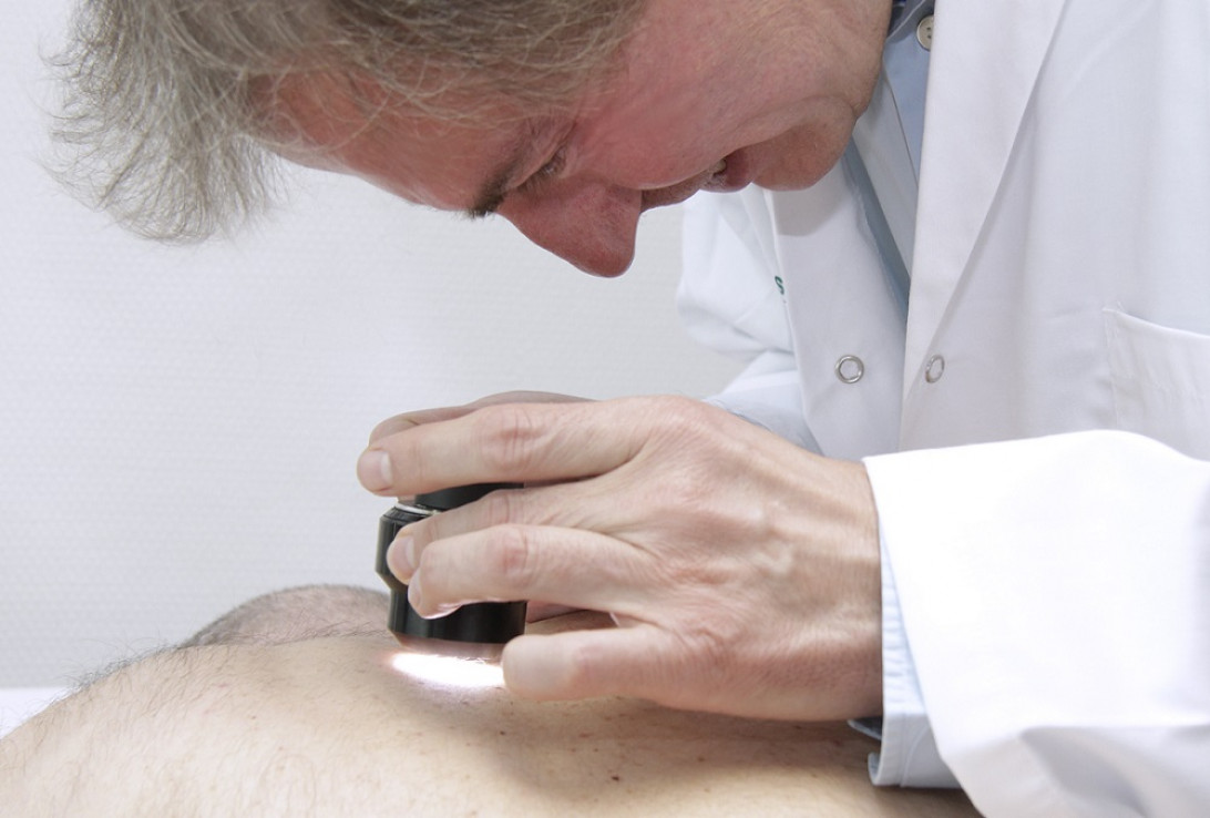 Esta imagen ilustra que: El Servicio de Dermatología participa en la Campaña del Euromelanoma  para el cribado del cáncer de piel