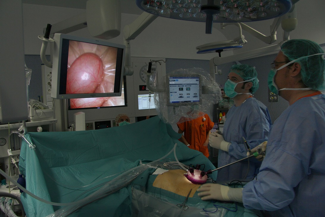 Esta imagen ilustra que: Son Espases aplica una tècnica de cirurgia mínimament invasiva per a les intervencions de fetge i d’extirpació de la vesícula biliar 