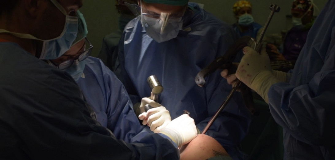 Esta imagen ilustra que: La Unidad de Trauma realiza con éxito el primer alargamiento de hueso con un sistema de transporte óseo interno mínimamente invasivo