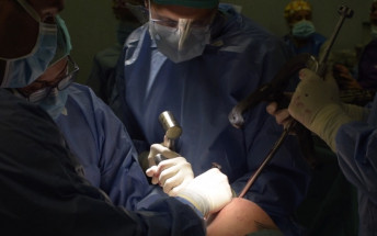 La Unitat de Trauma realitza amb èxit el primer allargament d’os amb un sistema de transport ossi intern mínimament invasiu