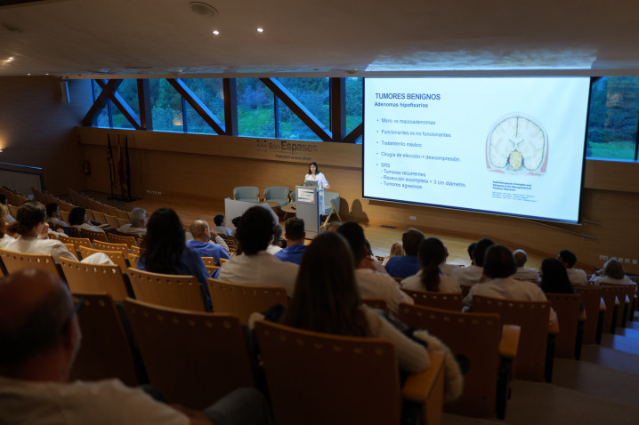 Son Espases consolida el programa de radiocirugía cerebral después de un año de haberlo implantado